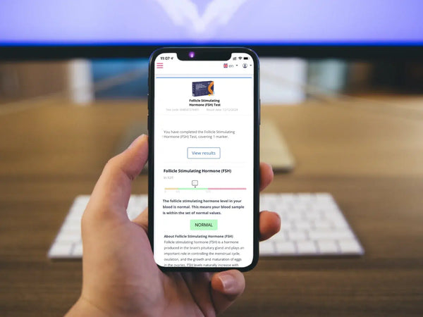 Luteinizing Hormone (LH) Test