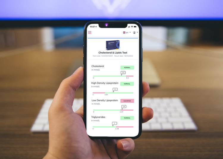 Umfassender Cholesterin-Test