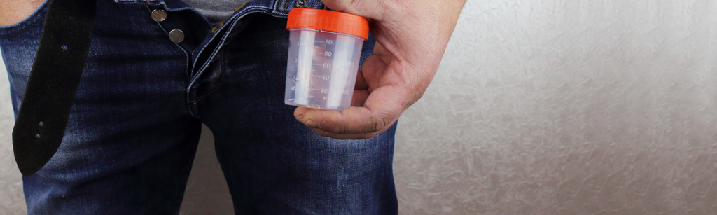 Urine tests for STIs: chlamydia, gonorrhea & more