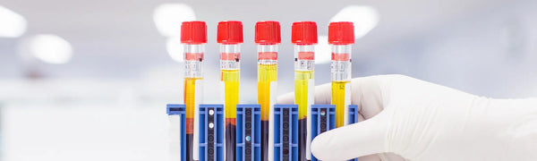 Welche Biomarker können zu Hause getestet werden?
