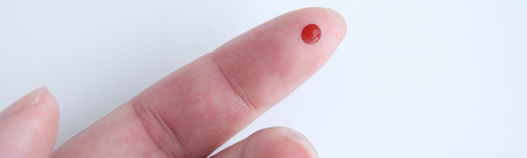 dried blood spot testing